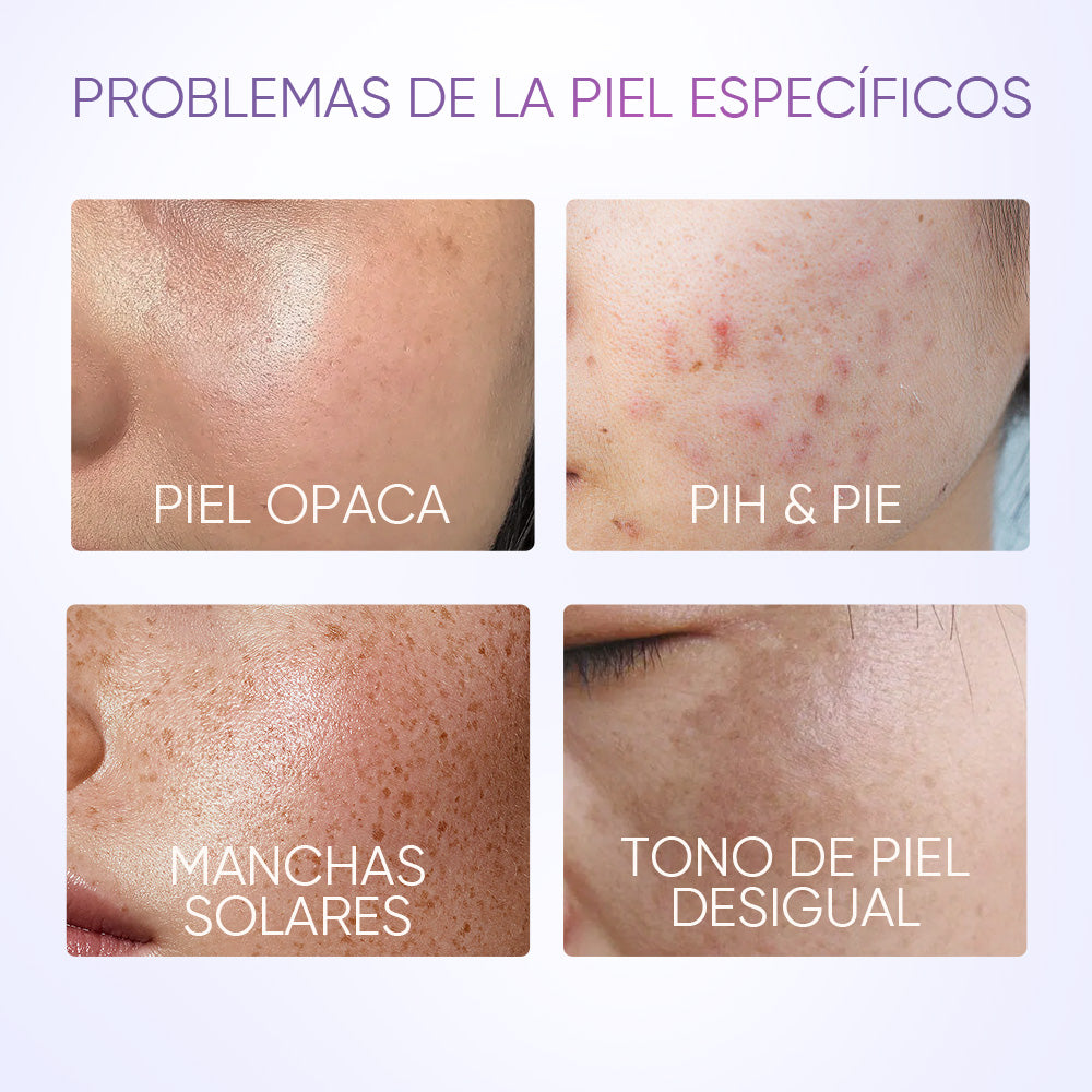 Gel Hidratante Anti-Manchas con SymWhite 377